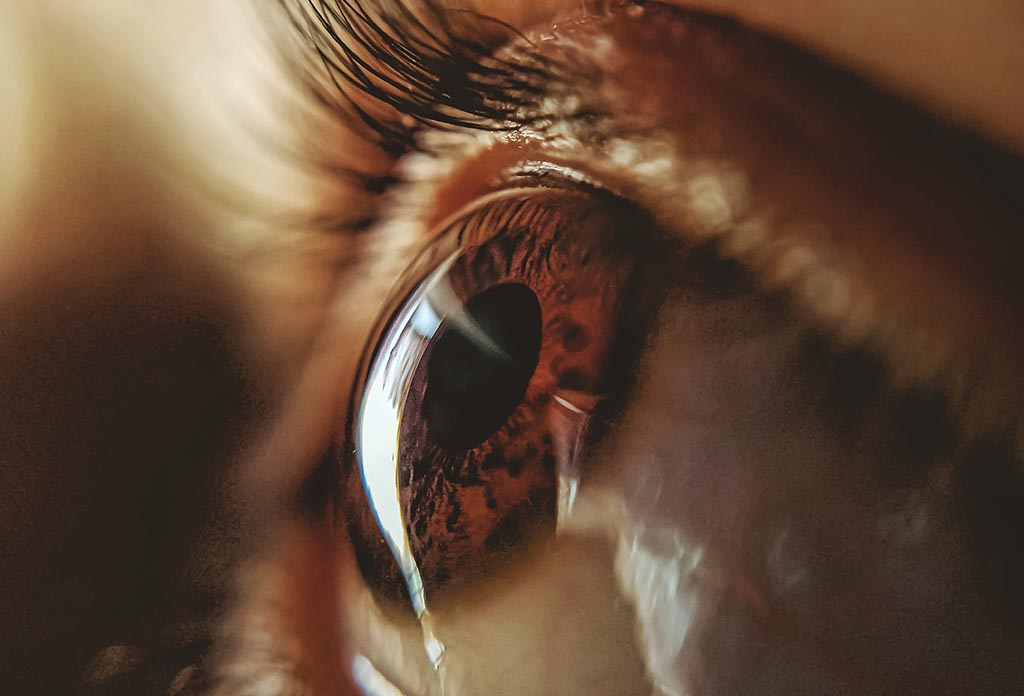 Eye